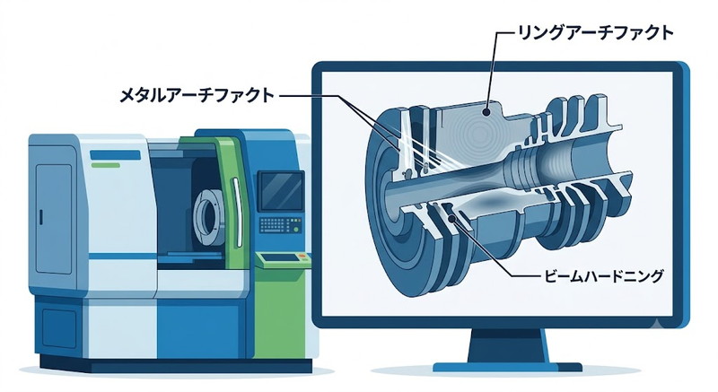 CT検査で発生するアーチファクトとは